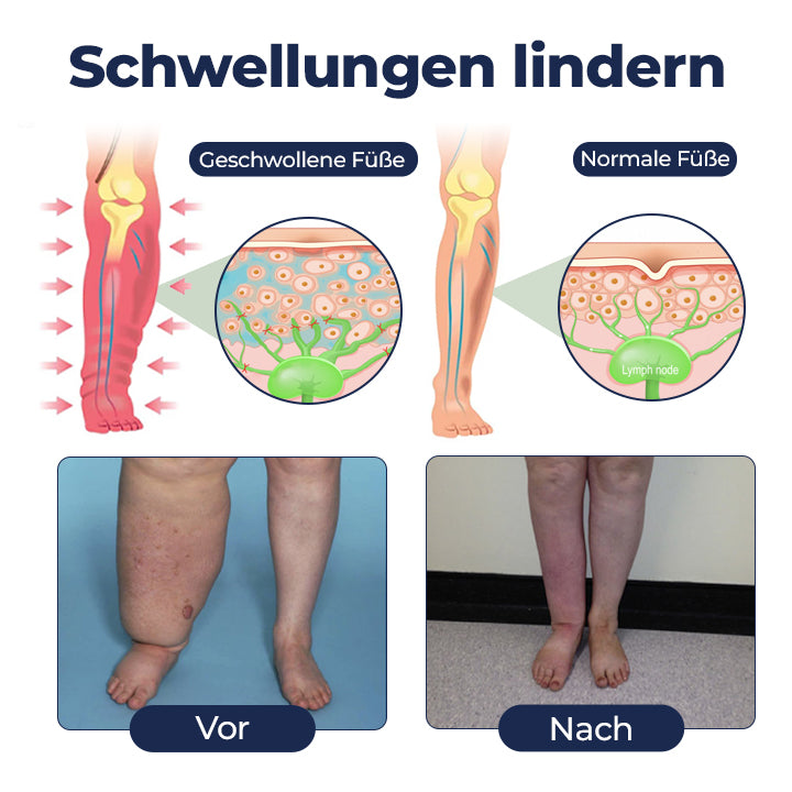 Timilk® SwellRelief Durchblutungsunterstützende Creme🔥