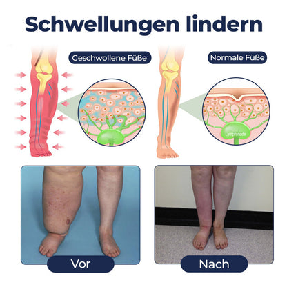 Timilk® SwellRelief Durchblutungsunterstützende Creme🔥