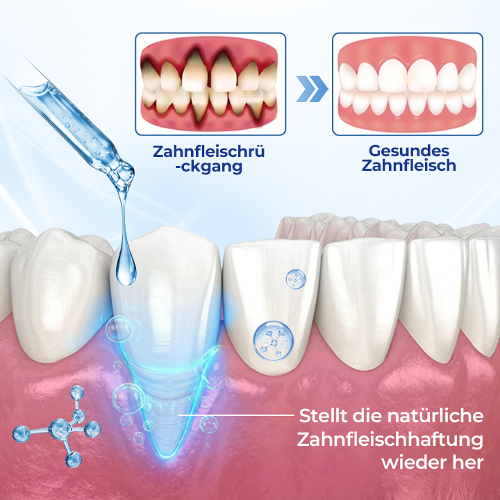 Biancat® BeeTakt Zahnfleisch-Repair Lösung✨