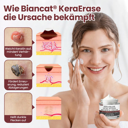 Biancat® KeraErase Dual-Action Erneuerungscreme ✨