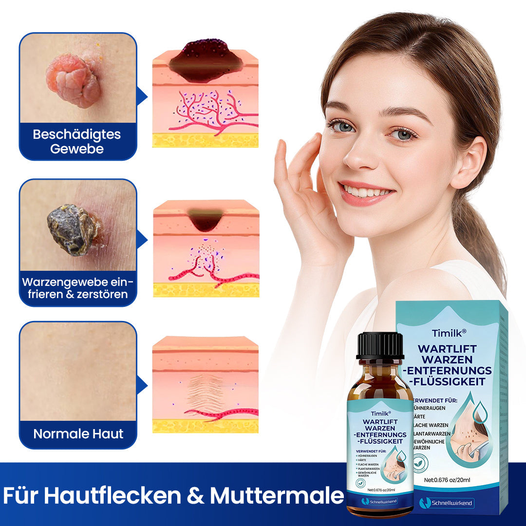 Timilk® WartLift Warzen-Entfernungsflüssigkeit ✨