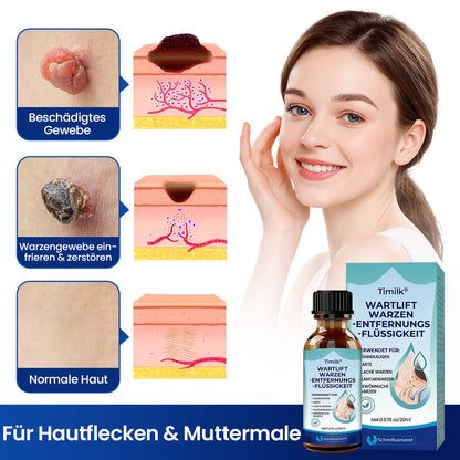 Timilk® WartLift Warzen-Entfernungsflüssigkeit ✨