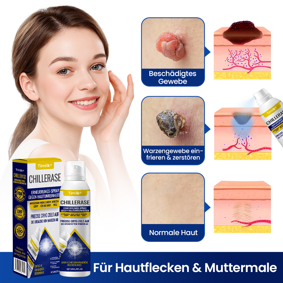 Timilk® ChillErase Erneuerungs-Spray gegen Hautunreinheiten🔥 (A)