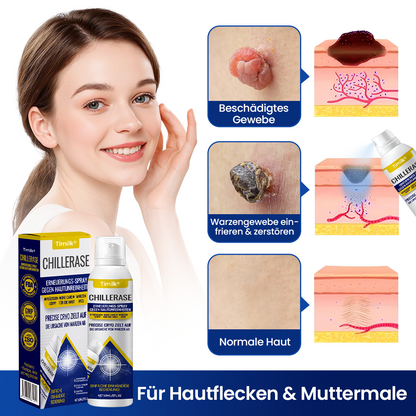 Timilk® ChillErase Erneuerungs-Spray gegen Hautunreinheiten🔥 (A)