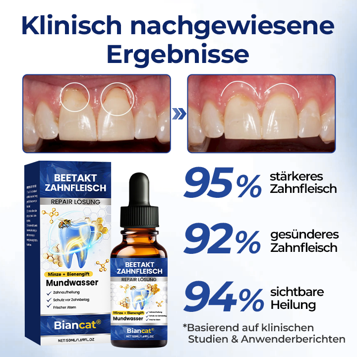 Biancat® BeeTakt Zahnfleisch-Repair Lösung✨