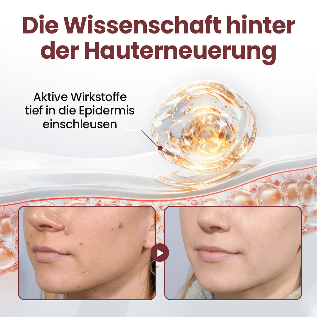 Biancat® KeraErase Dual-Action Erneuerungscreme ✨