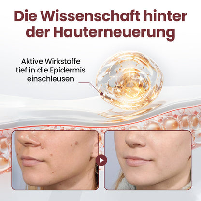 Biancat® KeraErase Dual-Action Erneuerungscreme ✨