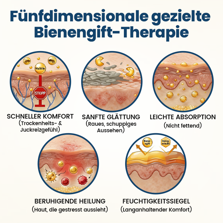 Timilk® BeeVenom Psoriasis-Behandlungscreme🔥