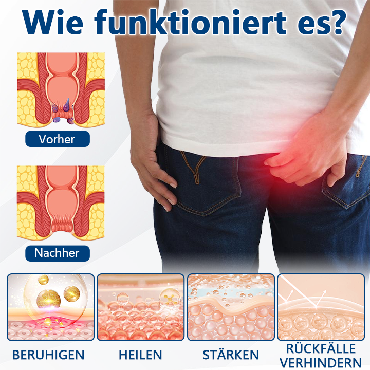 Timilk® HemoRelief Kräuterspray（A）