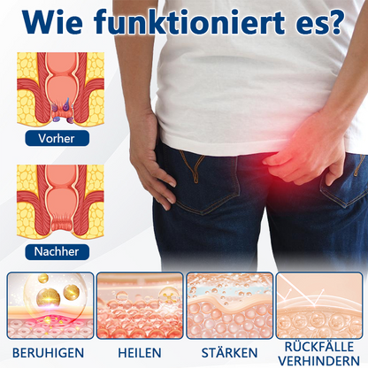 Timilk® HemoRelief Kräuterspray（A）
