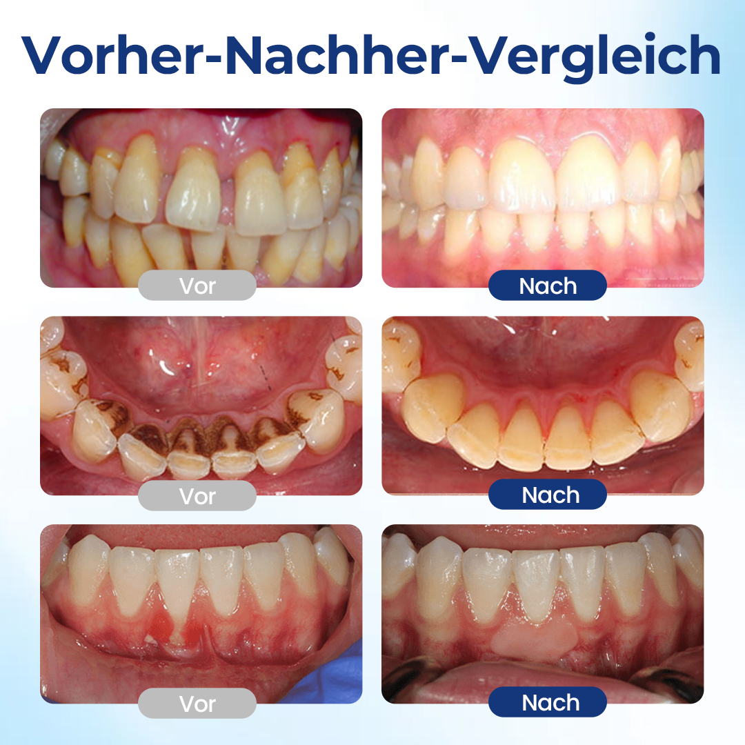 Biancat® BeeTakt Zahnfleisch-Repair Lösung✨