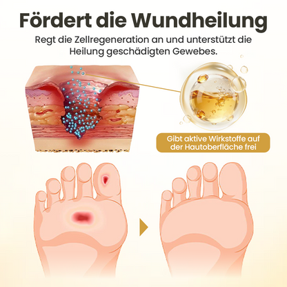 Timilk® GlucaVeil 24H Fuß-Barriere-Spray ✨