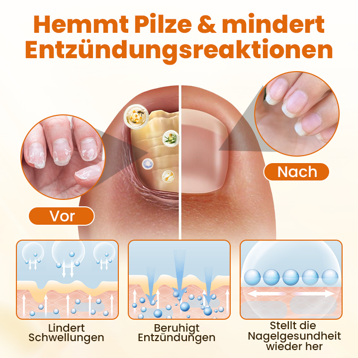 Timilk® FungiBee Fortschrittliches Nagelreparatur-Spray🔥
