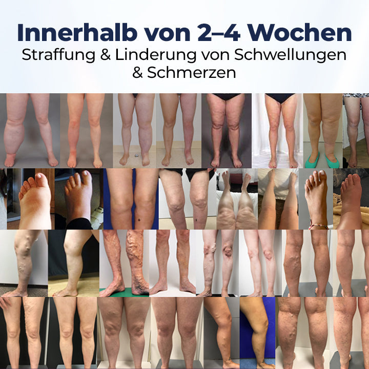 Timilk® SwellRelief Durchblutungsunterstützende Creme🔥