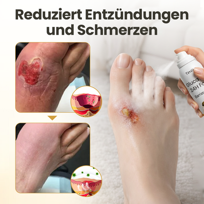 Timilk® GlucaVeil 24H Fuß-Barriere-Spray ✨