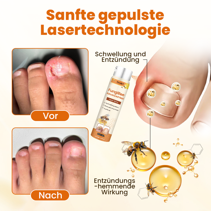 Timilk® FungiBee Fortschrittliches Nagelreparatur-Spray🔥