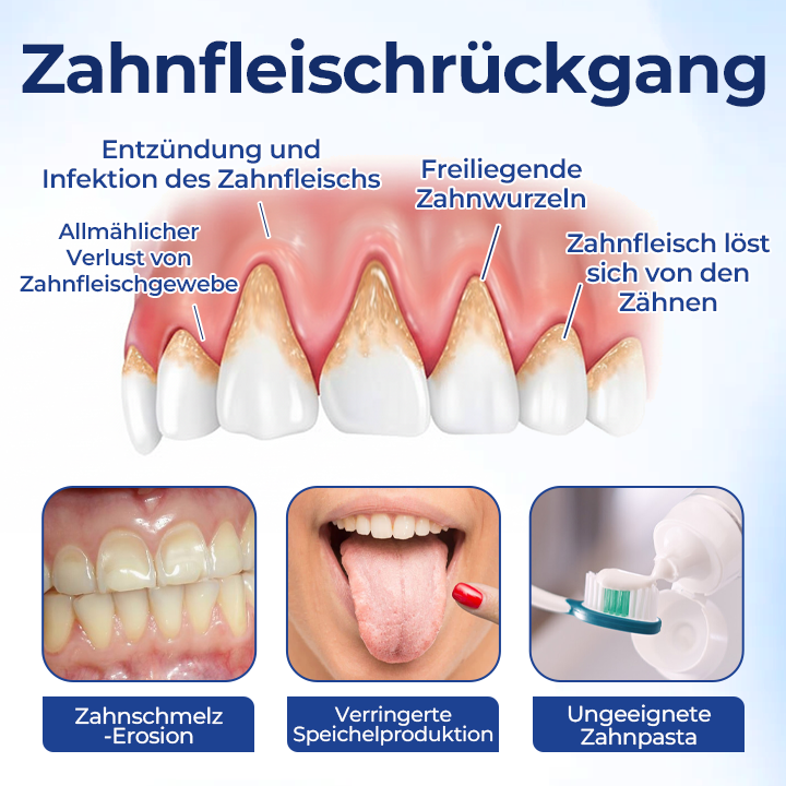 Biancat® BeeTakt Zahnfleisch-Repair Lösung✨