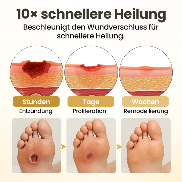 Timilk® GlucaVeil 24H Fuß-Barriere-Spray ✨
